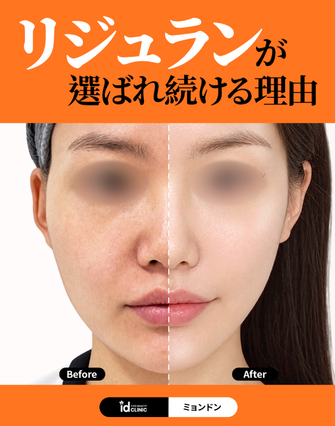 @idclinicjp · リジュラン、スキンブースター