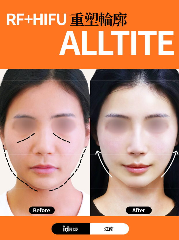 @id_skin_tw · AllTITE, RF+HIF 