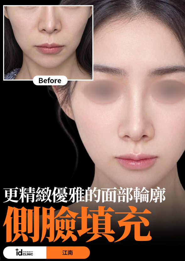 @id_skin_tw · 填充